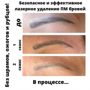 Косметология Фиброском фото 1 на сайте Fili24.ru